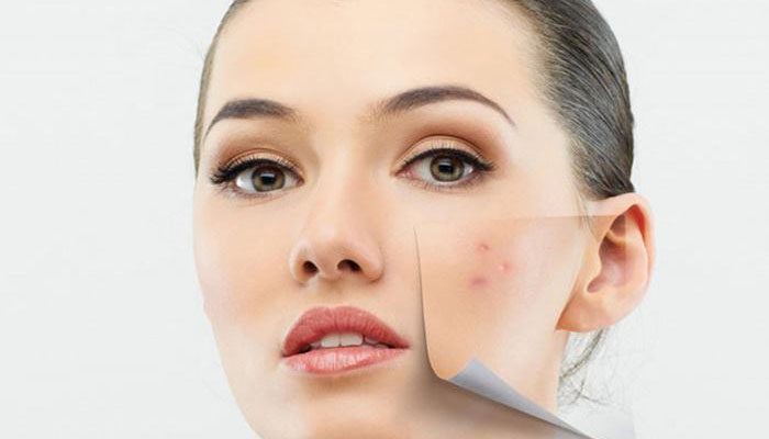 عوارض کرم روشن کننده سی گل حاوی هیدروکینون 6 عوارض کرم روشن کننده سی گل