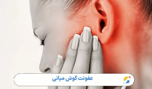 عفونت گوش میانی