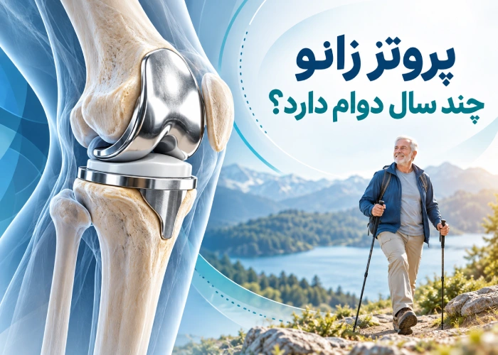 تعویض مفصل زانو چند سال دوام دارد؟ آمار ۱۵، ۲۰ و ۲۵ ساله 3 پروتز زانو چندسال دوام دارد